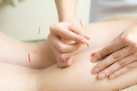 Acupuncture for Rheumatoid Arthritis Treatment